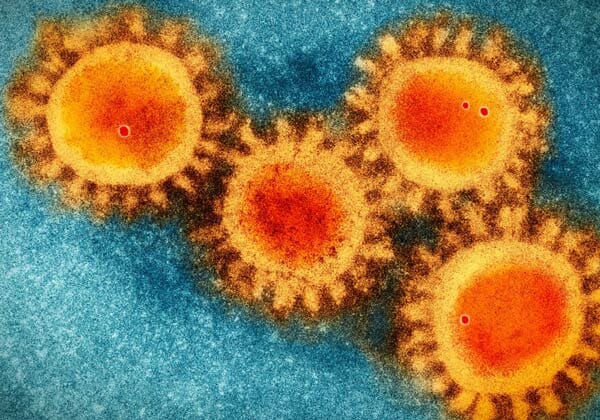 Coronavirus COVID-19 (SARS-CoV-2) - SCRIPPS RESEARCH INSTITUTE